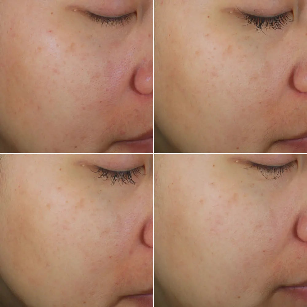 Novage+ Bright Intense Routine Mixed 5 step fecial