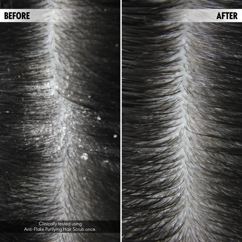 Anti-Flake Purifying Scalp Scrub